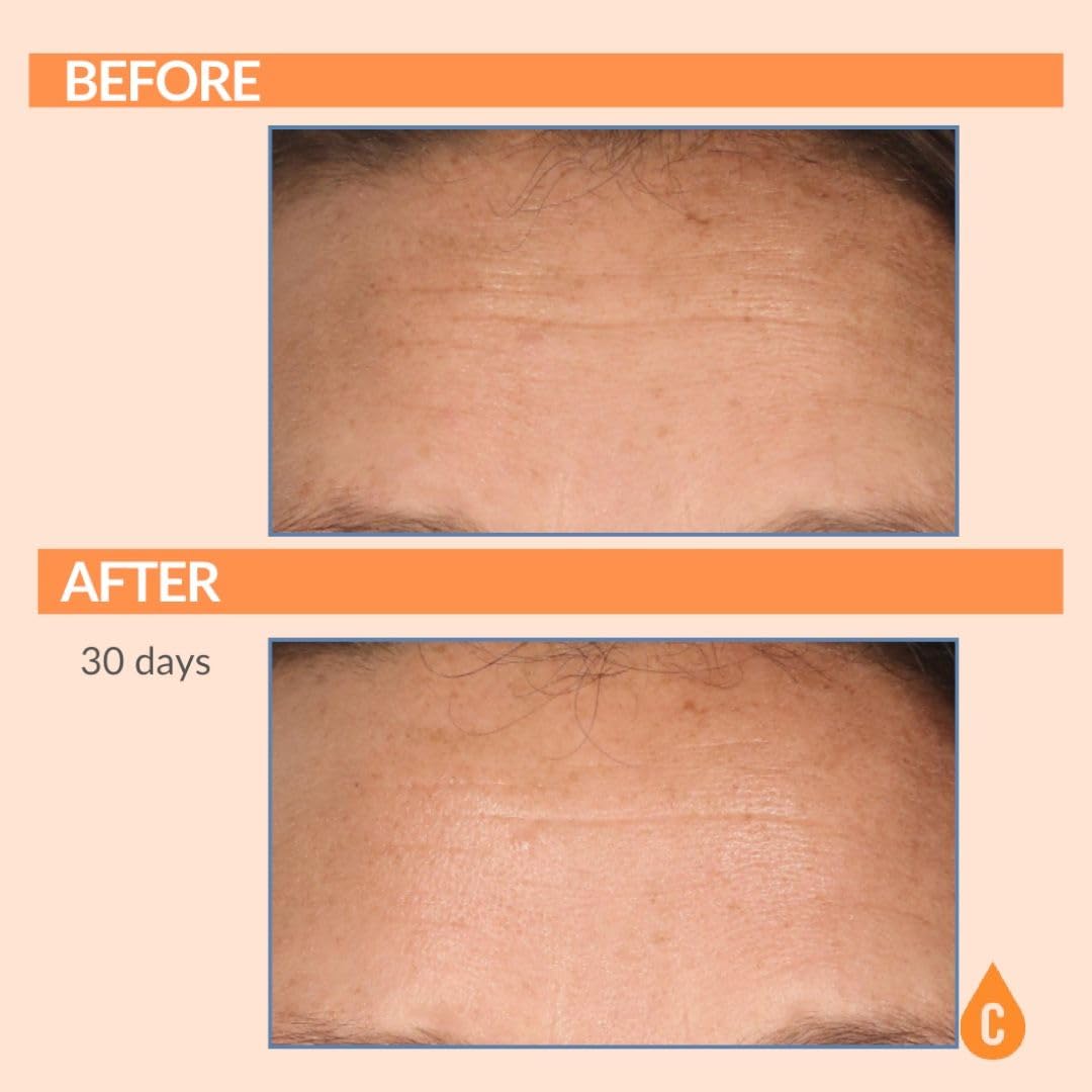 Serious Skincare Vitamin C Serum for Face, Anti-Aging Face Serum with Collagen, Vitamin E, Hydrating Skin Care for Brightening, Improve Appearance of Dark Spots, Tone, Fine Lines & Wrinkles 1 Fl Oz