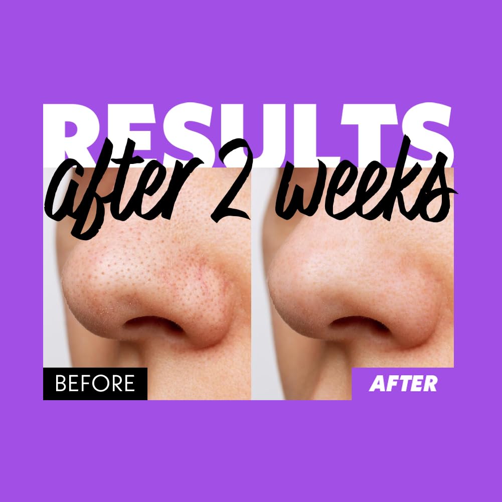 Nosca9 Deep Pore Cleansing Foam for Sensitive Skin | Korean Skincare Face Wash with 17 Amino Acids, White Clay & Patented Pore-Shrinking Ingredient | Deep Cleansing & Moisturizing (5.07 fl. oz)