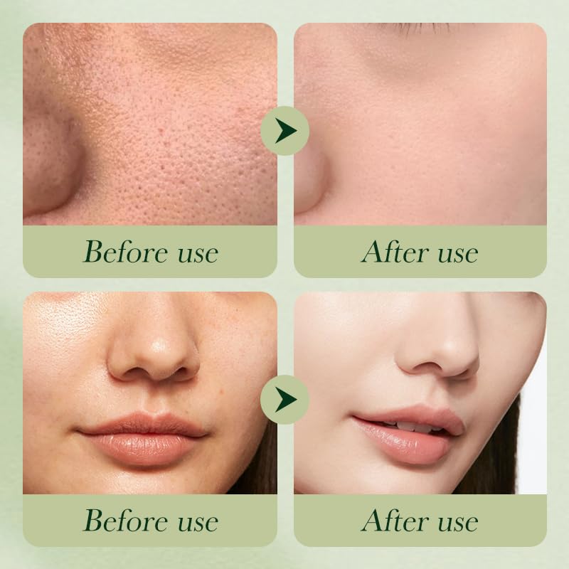 Avocado Skincare Sets, 6Pcs Skincare Gift Set with Facial Cleanser, Face Serum, Face Cream, Eye Cream, Toner, moisturizing Lotion, Skin Care Sets & Kits, Hydrating Facial Kit for women