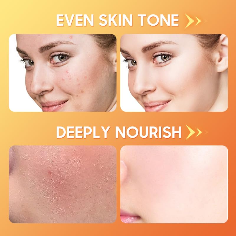 6 Pcs -Vitamin C Skincare Set for Face - with Cleanser, Serum, Eye Cream, Moisturizer, Sunscreen & Toner | Brightening, Hydrating& Anti-Aging,Perfect for Teens & Girls,Moisturizing Face Skin Care Kit