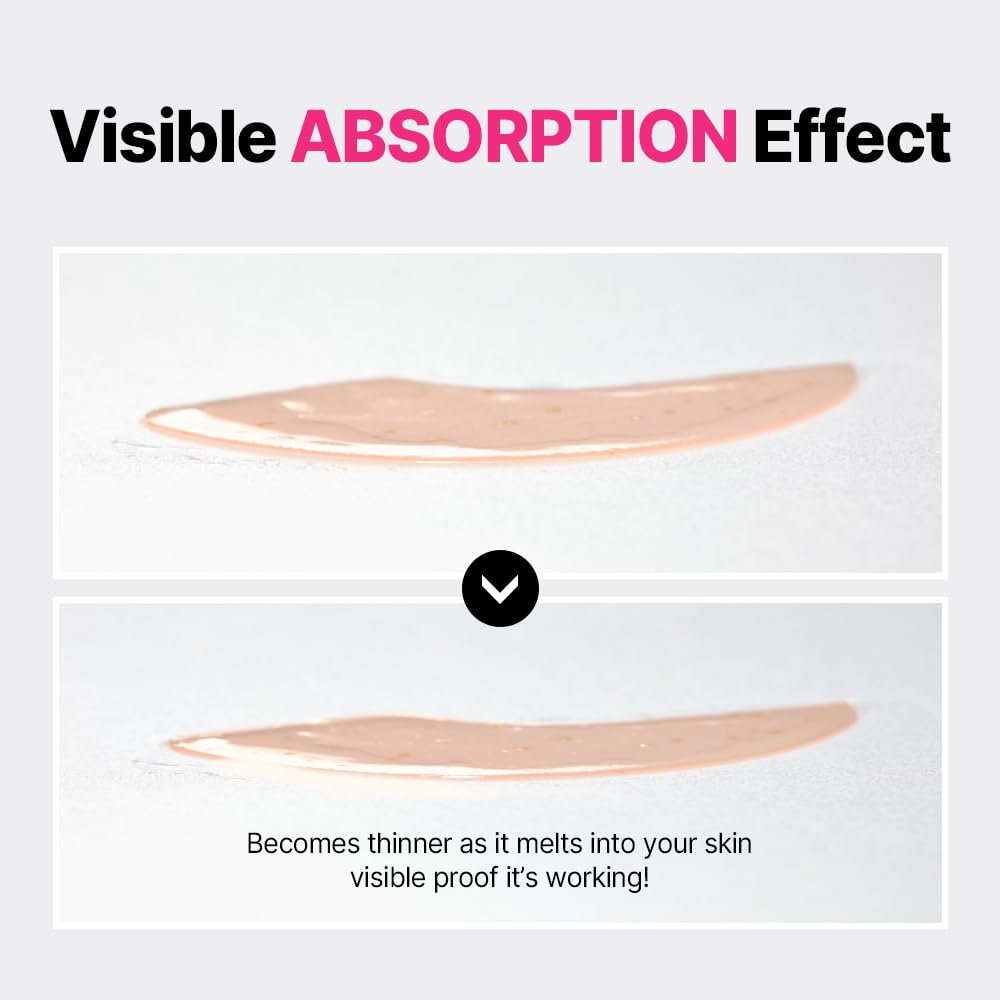 ISOI Blemish Care Under Eye Patch for Dark Circles, Puffiness and Wrinkles, Hydrating Gel Eye Masks with Hyaluronic Acid & Bulgarian Rose Oil, Korean Skin Care (90 pcs, 3.17 oz)