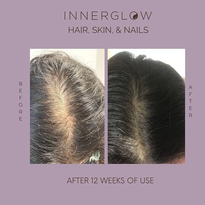 Advanced Hair, Skin & Nails Formula - Dermatologist and Plastic Surgeon Developed, clinically Tested for visibly Stronger and Thicker Hair in 12 Weeks