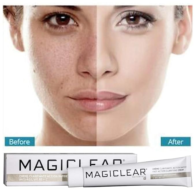 Luxury blemish spot treatment Cream - Dark spot corrector remover cream. Organic spot treatment. Best Swiss brand 50 ml.