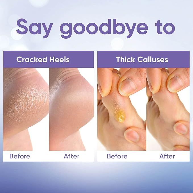 Foot Peel Mask - Foot Mask for Baby Soft Skin - Remove Dead Skin, Dry, Cracked Feet & Callus, Foot Spa, Made with Aloe Vera Extract for Women and Men (3 Pair (Pack of 1), Lavender)