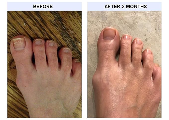 TIPS Toe Nail Conditioner 2 Pack