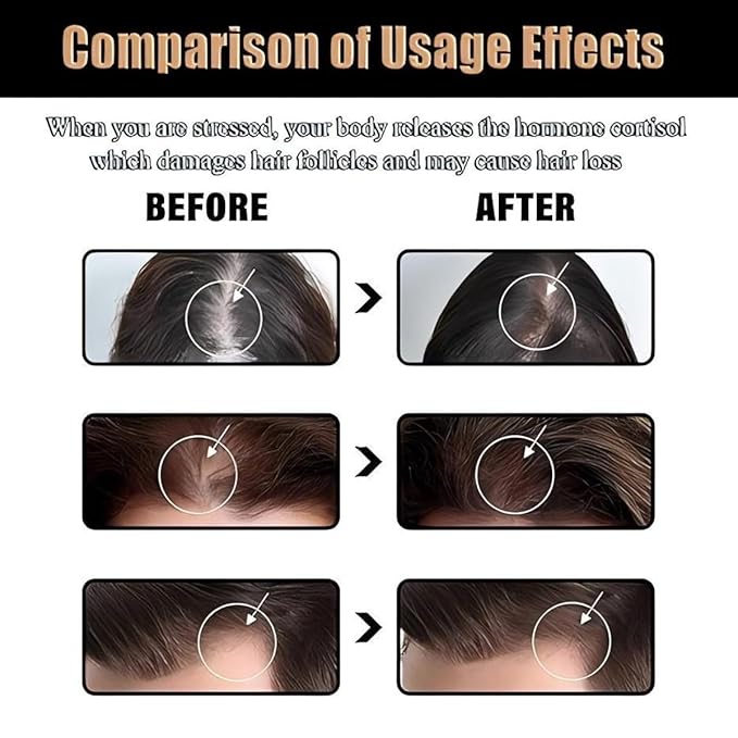 Shampoo, Root Activating Shampoo, Hair Thickening Shampoo,Natural Hair Regrowth Shampoos for Men Women(100ML)