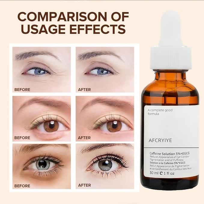 New Caffeine Solution 5%+ EGCG, Facial Caffeine Eye Serum, Moisturizing Eye Solution, Can Reduce Dark Circles And Puffiness.Caffeine Under Eye Serum,30(ML)