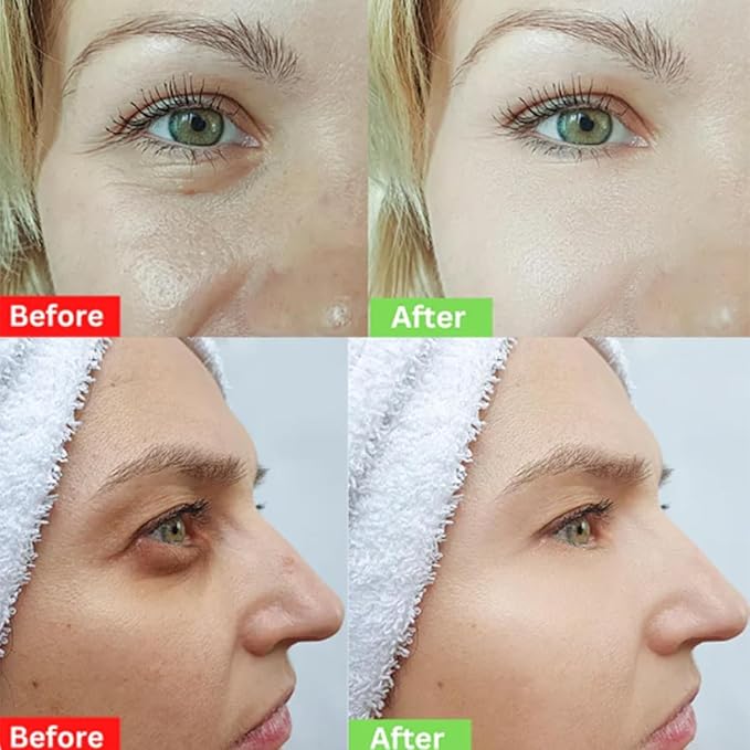 Naturals Instant Eye & Face Lift Cream Rapid Under Eye Bags Wrinkles Puffiness Remover for Women and Men in 60s -Temporary Firming & Tightening Treatment - Wrinkle Filler (3pcs)