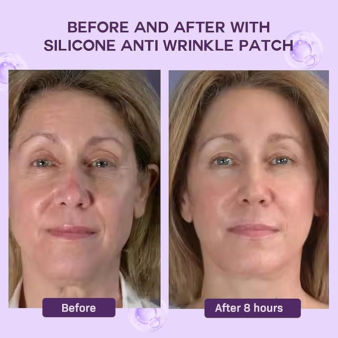 ACADA Anti Wrinkle Patches – Reusable Silicone Face Patches for Forehead Eyes Mouth Neck and Chest Wrinkle Patches for Firming & Lifting (Gel Patches 11pcs)