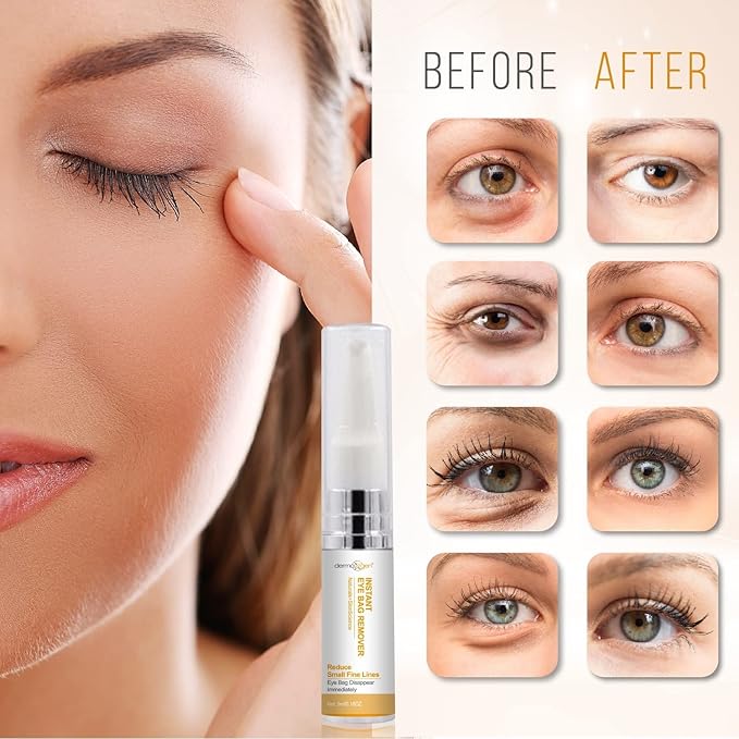 Eye Gel with Plant Stem Cells & Peptide Complex for Under & Around Eyes – Reduces Puffiness, Dark Circles & Fine Lines – With Matrixyl 3000 & Arginine for a Smoother, Refreshed Look for Men & Women.