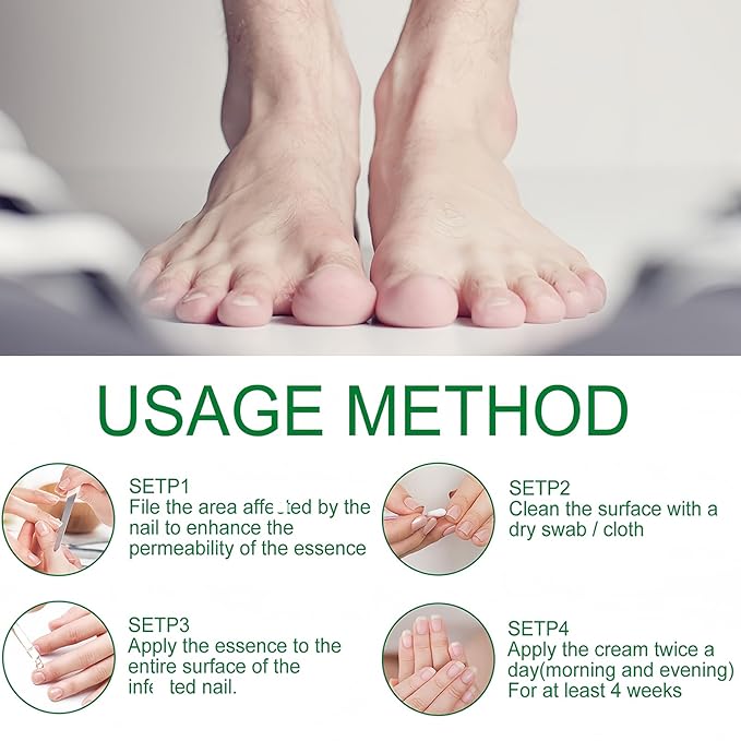 Ginger Nail Strengthener for Damaged Nails, 1Pc Treatment Oil, Ginger Nail Serum for Cracked Nails, Hand & Foot Strengthener, Fingernail Repair for Split Toenail, 30ML