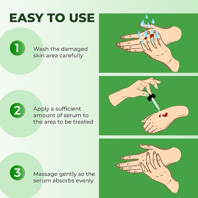 ABERA Alan Silver Serum - Clinically Proven to Soothe Irritated Skin and Improve The Appearance of Skin with Mild to Moderate Psoriasis