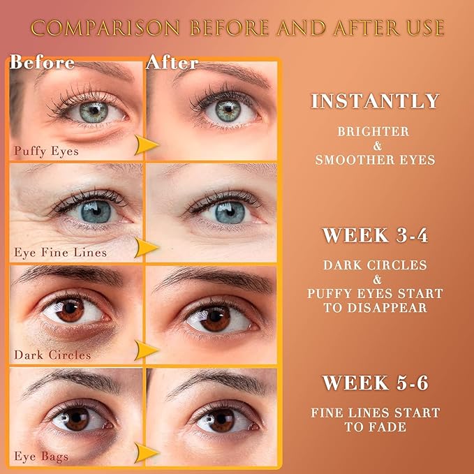 24K GOLD Eye Maskโ 60 Pcs - Gold Under Eye Mask Retinol & Collagen - Puffy Eyes and Dark Circles Treatments โ Look Younger and Reduce Wrinkles and Fine Lines Undereye, Improve and Firm eye Skin