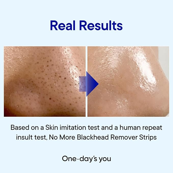 ONE-DAY’S YOU PZ SSOC SSOC Blackhead Remover Strips | Korean Pore Strips for Face & Nose | Deep Cleansing Pore Strips | Blackhead Remover with Sulfur, Tea Tree, & Salicylic Acid | 2.7 fl
