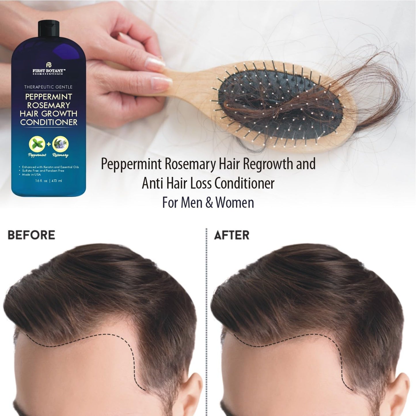 Peppermint Rosemary Hair Regrowth Conditioner - Anti Hair Loss product, Daily Hydrating, Detoxifying, Volumizing Conditioner and Fights Dandruff For Men and Women 16 fl oz