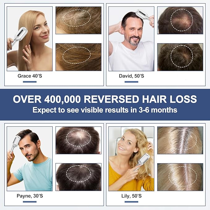Laser Therapy Hair Growth Comb,FDA Cleared laser comb for hair growth,Red Light Electric Scalp Massager