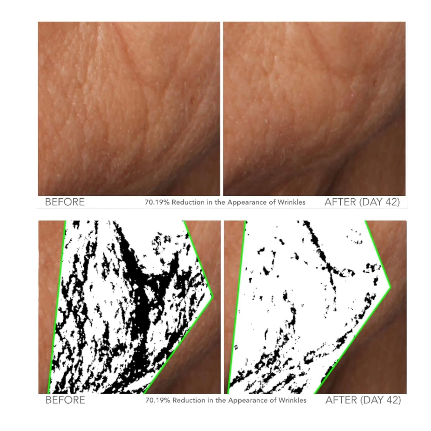 Serious Skincare - Beyond Intensive Vitamin C Serum for Face - 60 Day Facial Treatment for Healthy Glowing Skin and Brightening - Smoothes Lines, Pores and Fades Dark Spots - 2 Piece Anti-Aging Set