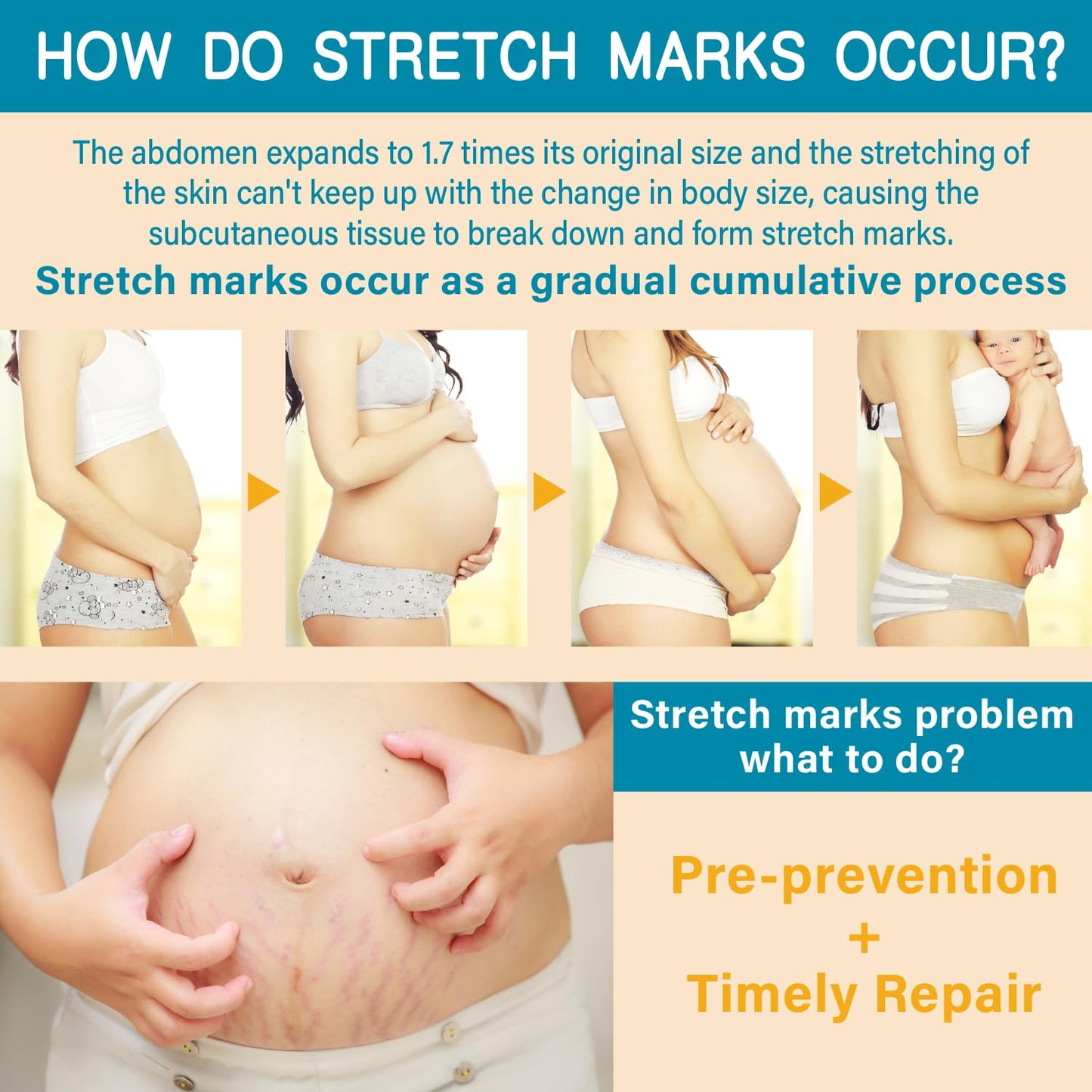 PEGO Stretch Mark Oil for Pregnancy, Maternity Body Oil for Stretch Mark Prevention & Reduction, Hydrating Skin Care, 4.06oz (2Pack)