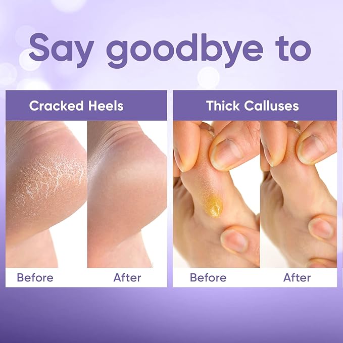 Foot Peel Mask - Foot Mask for Baby Soft Skin - Remove Dead Skin, Dry, Cracked Feet & Callus, Foot Spa, Made with Aloe Vera Extract for Women and Men (5 Pairs Lavender)