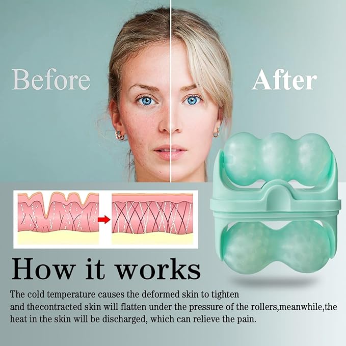 Ice Roller for Face and Eyes Facial Skin Care Tool 2-in-1 Ice Roller for Face & Eyes - Reduces Puffiness, Relieves Migraines, with Travel Case - Ideal Gift for Women (Green)