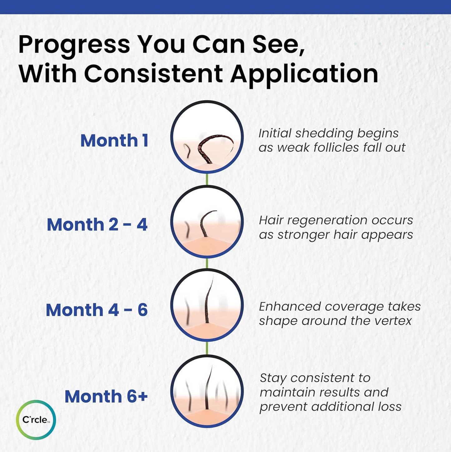 C’rcle Men's Minoxidil 5% Foam - Unscented 6 Month Supply - Helps Restore Vertex Hair Loss & Thinning - Extra Strength Supports Hair Regrowth for Men