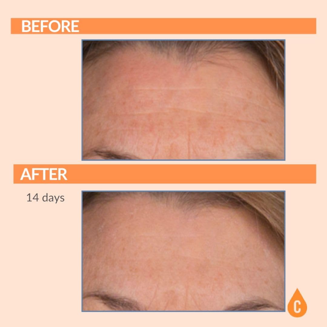 Serious Skincare Vitamin C Serum for Face, Anti-Aging Face Serum with Collagen, Vitamin E, Hydrating Skin Care for Brightening, Improve Appearance of Dark Spots, Tone, Fine Lines & Wrinkles 1 Fl Oz