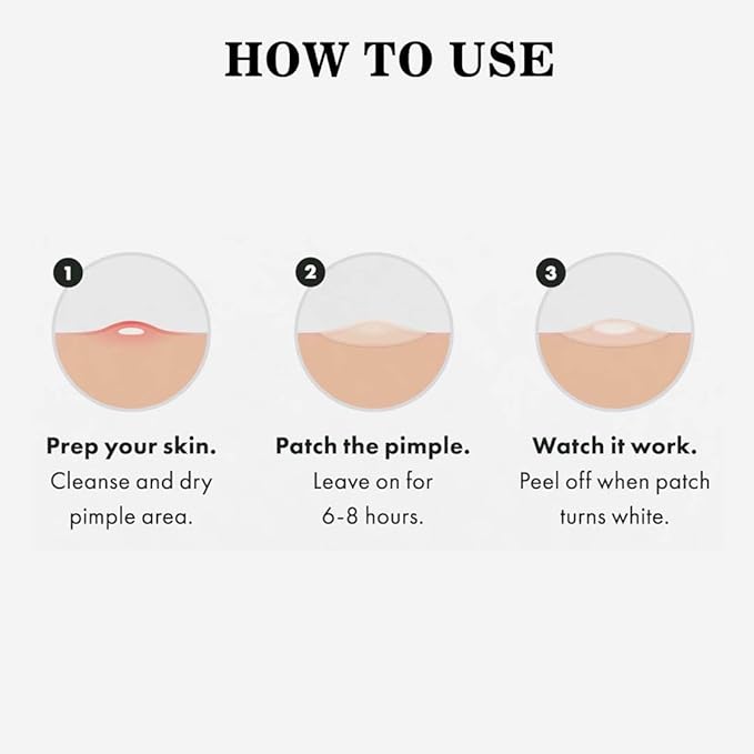 ABC Pimple Patches (36 Count)