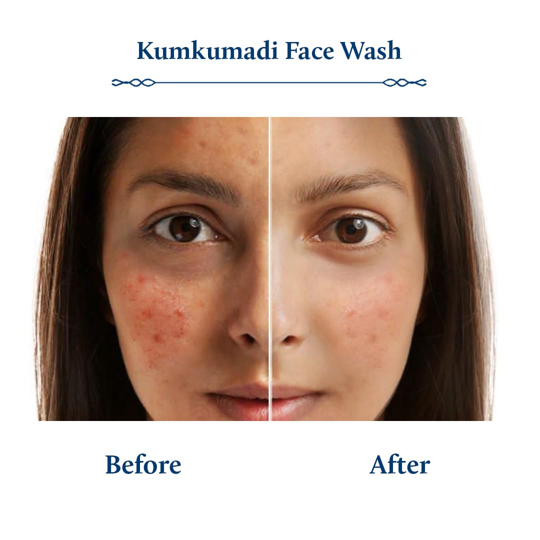 Blue Nectar Kumkumadi Brightening Face Wash with Saffron for Women & Men | Sulphate free Anti Pimple Face Cleanser (10 Herbs, 6.76 Fl Oz)
