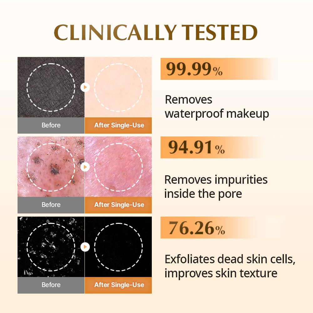 UIQ Biome Barrier Firming Collagen Cleansing Balm | Hygenic One-Step Makeup Remover | Non-Greasy Sorbet Texture | Gentle, Soothing for All Skin Types | No.1 Oliveyoung Cleanser | 3.38 fl. oz.