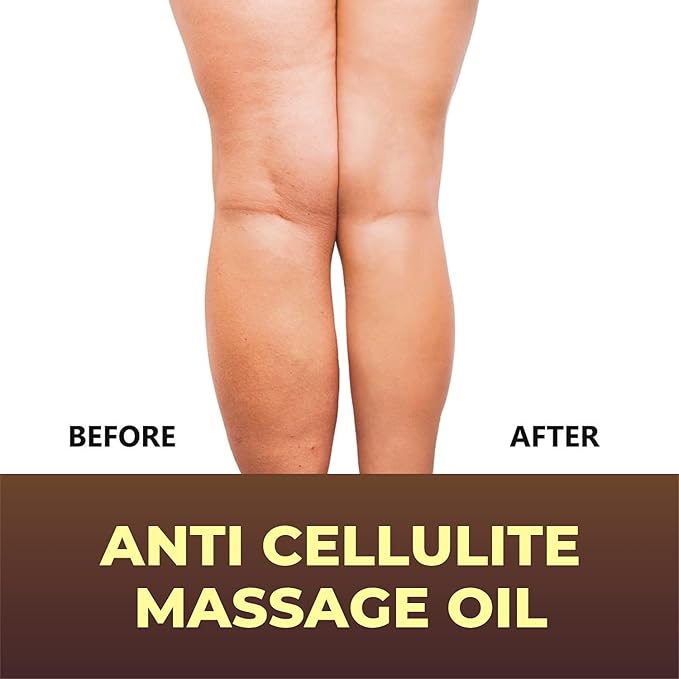 First Botany, Anti-Cellulite Massage Oil Infused with Collagen & Stem Cells - Natural Cellulite & Stretch Mark Treatment for Men & Women - 8 oz