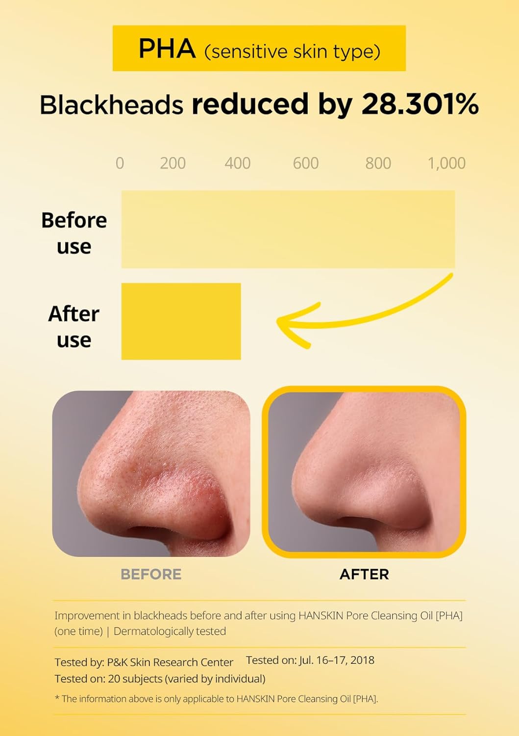 Hanskin Pore Cleansing Oil, Oil Cleanser for Face, Makeup Blackhead Sebum Remover, Korean Deep Pore Cleanser for Sensitive Skin [PHA] (10.14 oz)