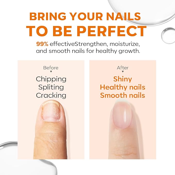 modelones 15ml 8-in-One Nail Ridge Filler Strengthener Base Coat Nail Polish Repair Nail Growth Treatment for Thin and Damaged Nails, Crystal Clear