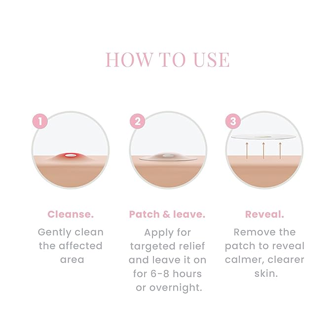 83 Everyday Spot Control Patches Hydrocolloid Pimple Patches with Salicylic Acid & Tea Tree Oil to Exfoliate - Centella Oil Infused Acne Patches - Shields, Revives & Rescues Skin