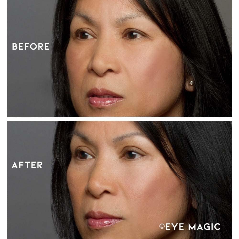 Premium Instant Eyelid Lift (L/XL-Refill). Look Younger Instantly | Made in America - Lifts and Defines Droopy, Sagging, Hooded Eyelids For A Youthful Look