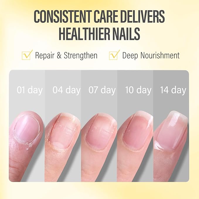 CHUCHU Nail Strengthener - Pineapple Scent Nail Repair Growth Moisturizing Treatment - Natural Jojoba Vitamin B & E Cuticle Oil for Dry Cracked Nails
