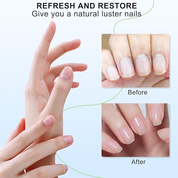 Cuticle Oil Cuticle Remover Set, Moisturizing Repairing Nail Oil, Plant-Based Formula for Damaged Nails Dry Cuticles, Strengthening Hydrating, Rose, Jasmine, Lavender, Nail Care, 4pcs/7ml,YNC-001