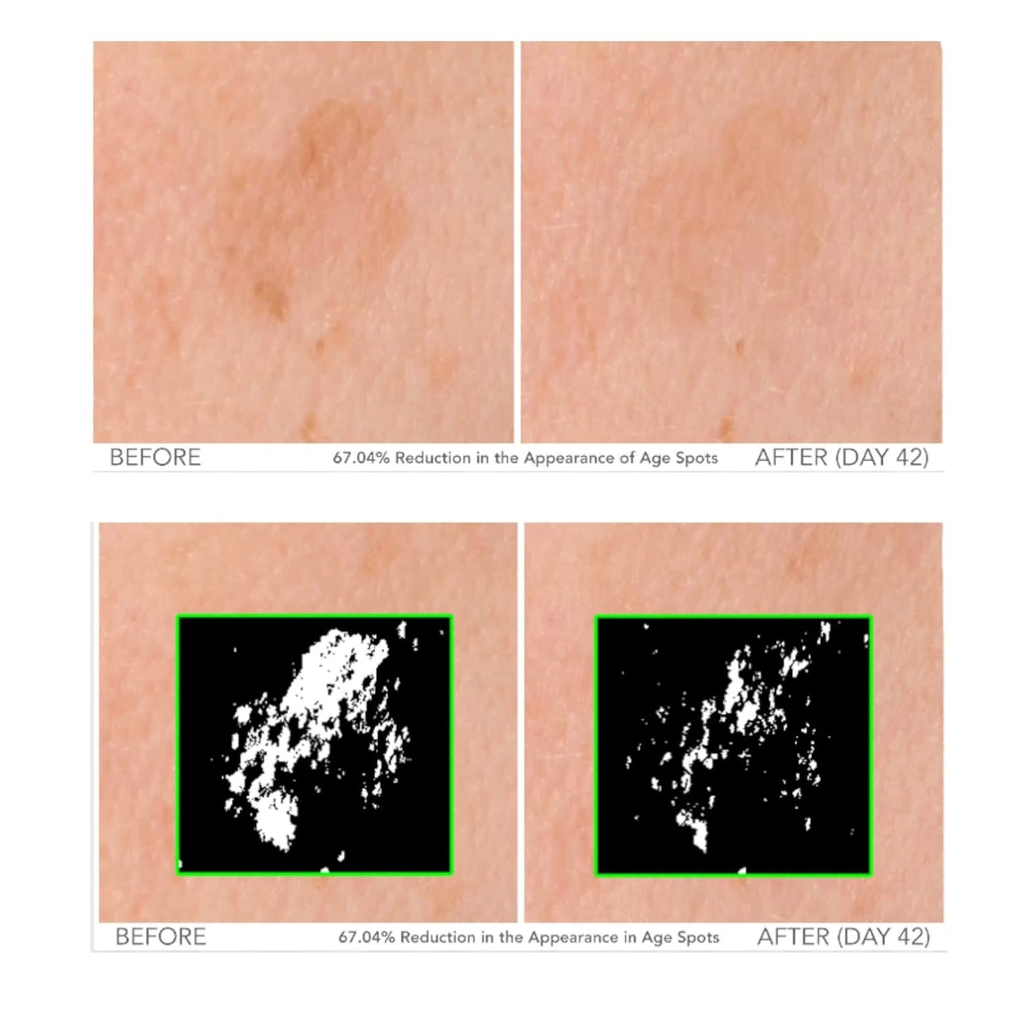 Serious Skincare - Beyond Intensive Vitamin C Serum for Face - 60 Day Facial Treatment for Healthy Glowing Skin and Brightening - Smoothes Lines, Pores and Fades Dark Spots - 2 Piece Anti-Aging Set