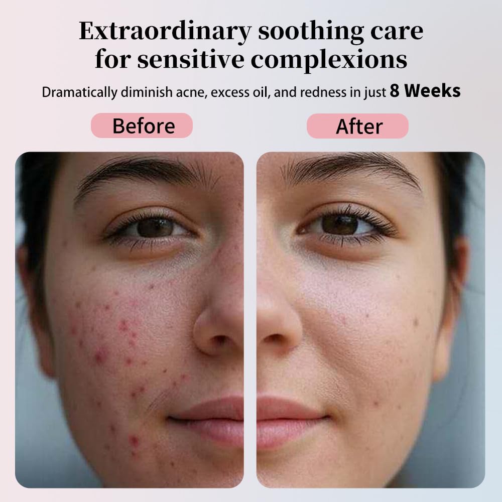 Disposable Face Towels, 10"×12" Face Towel, Towelettes XL, Ultra Soft & Thick Makeup Remover Dry Wipes for Sensitive Skin, Chemical Free 50 Count (1 Pack)