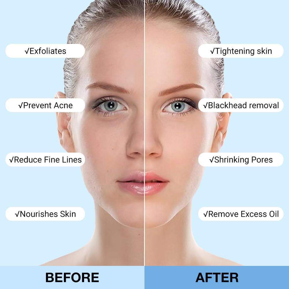 2Pcs Clay Mask For Face, Blackhead Remover For Face, Deep Pore Cleansing, Moisturizing, Skincare Facial Mask for Refining Pores and Controlling Oil (A02#2Pcs Blueberry)