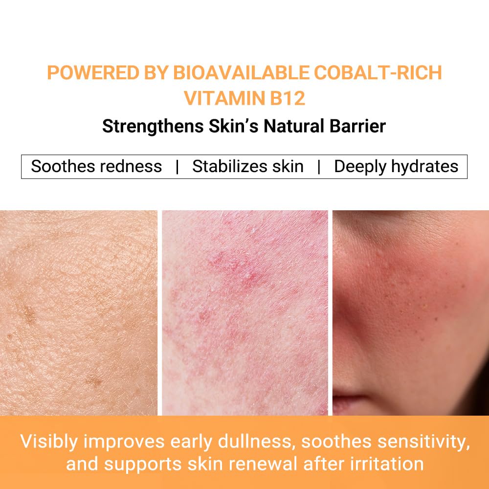 Vitamin B12 Lotion (1 oz) | Repair & Hydrating Cream for All Ages （teen & adult| Soothes Redness, After-Sun Skin Relief, Strengthens Barrier, Sensitive Skin Safe