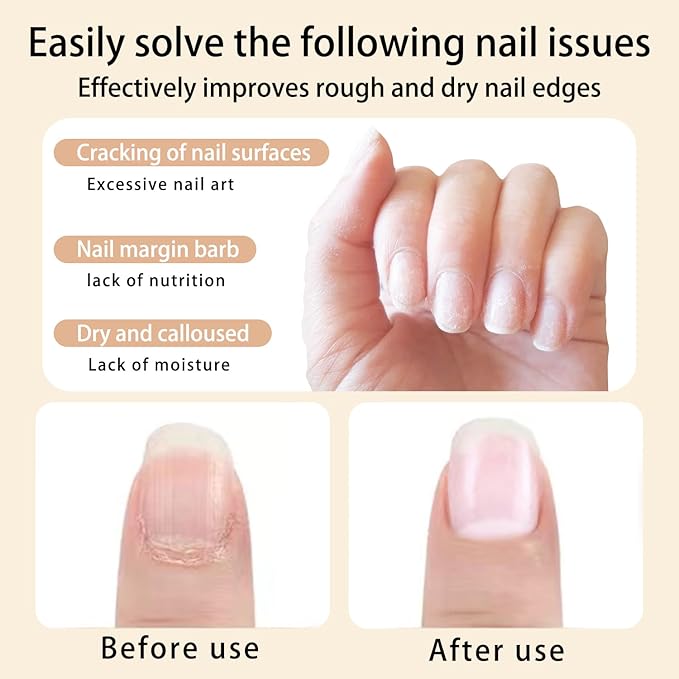 Cuticle Oil Pen for Nails Care,Nail Oil For Strength,Nourish Moisten Care Cuticle To Reduce Nail Cracking and Dry for Weak Peeling Brittle and Thin Nails (blueberries&cherry)