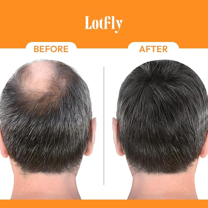 Biotin 10000 mcg with Zinc, Vitamin C & Calcium Pantothenate – Supports Healthy Hair Growth, Strong Nails & Glowing Skin for Women & Men | Made in The USA | 180 Vegan Capsules (6 Months Supply)