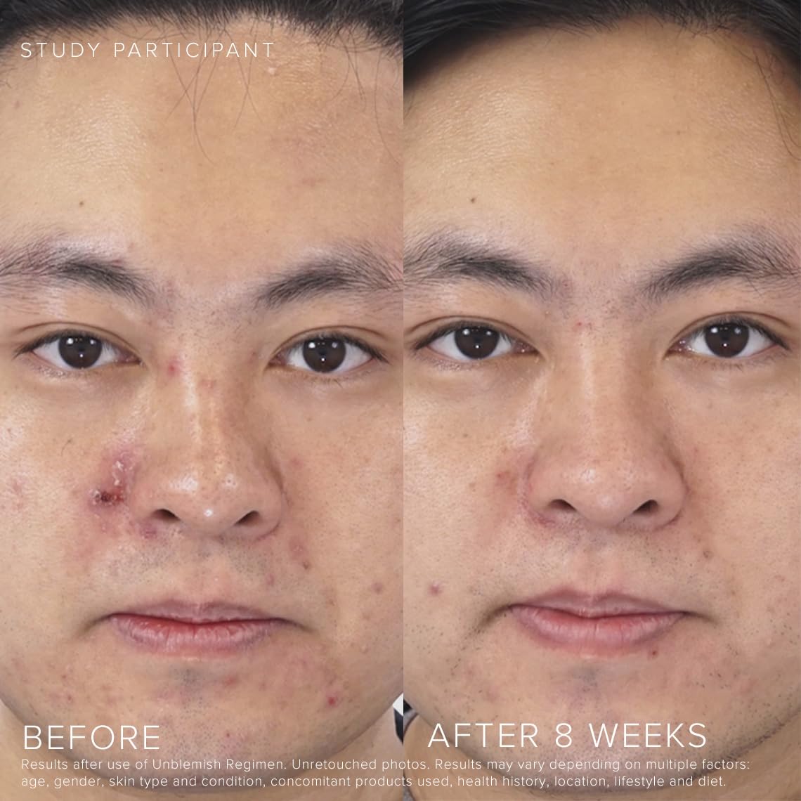 Rodan + Fields UNBLEMISH Invisible Matte Defense Broad Spectrum SPF 30 | Skincare Moisturizer | UV Skin Protection | Sunscreen Face and Neck Cream