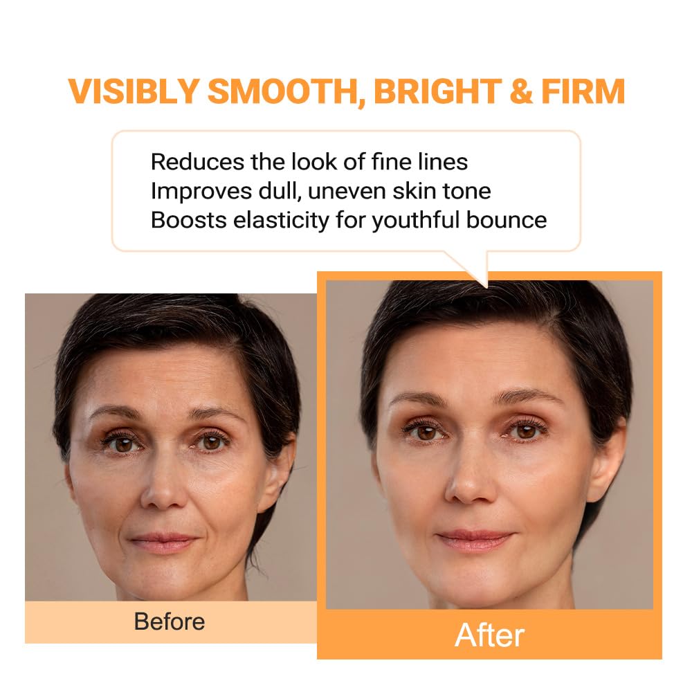 Vitamin B12 Lotion (1 oz) | Repair & Hydrating Cream for All Ages （teen & adult| Soothes Redness, After-Sun Skin Relief, Strengthens Barrier, Sensitive Skin Safe