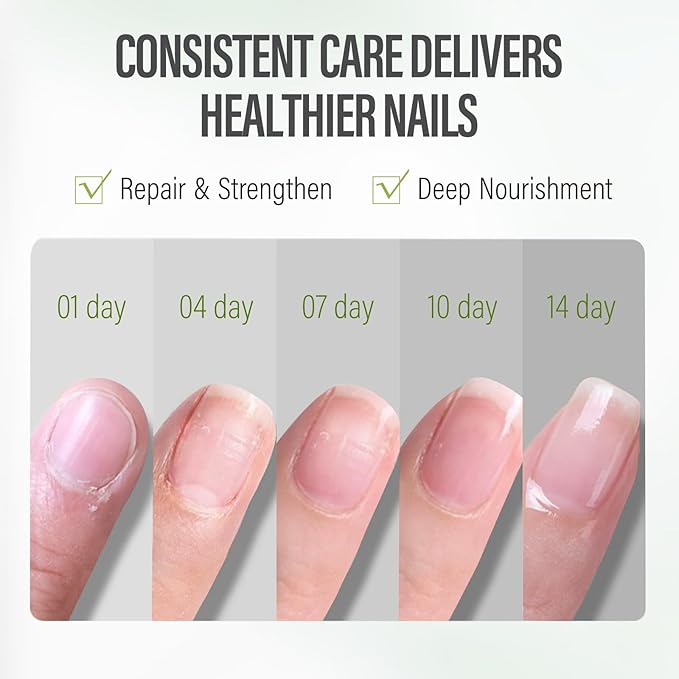 CHUCHU Nail Strengthener - Aloe Vera Nail Repair Growth Moisturizing Treatment - Natural Jojoba Vitamin B & E Cuticle Oil for Dry Cracked Nails