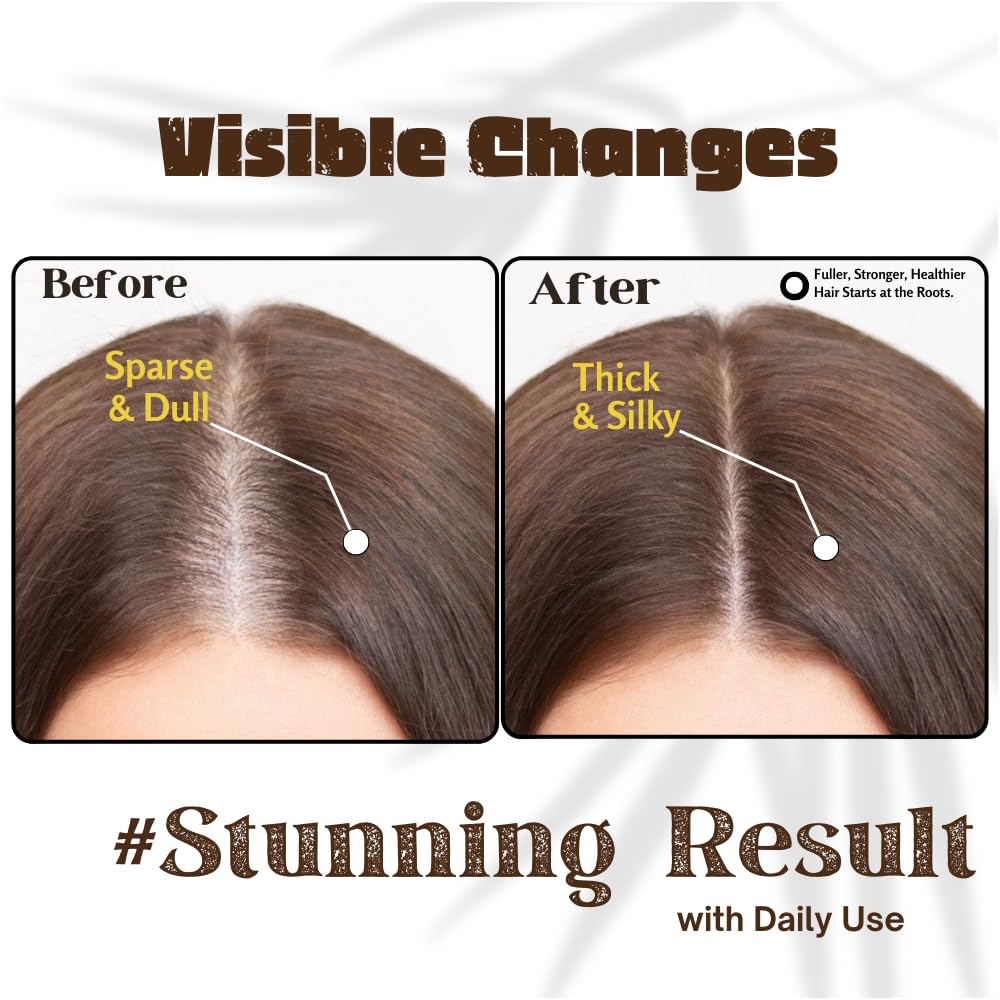 Rosemary Oil For Hair Growth (3.4 Fl Oz) Infused With Biotin, Vitamin E, Almond Oil & Coconut - Hair Strengthening, Nourishing & Volumizing