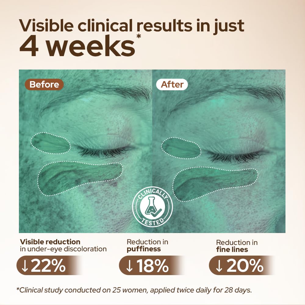 Youth 1700 Caffeine Eye Cream, Under Eye Brightener & Anti-Aging with Peptides, Hyaluronic Acid, Niacinamide, Bakuchiol, Vietnamese Ginseng for Dark Circles, Puffiness, Wrinkles and Hydrating Skin