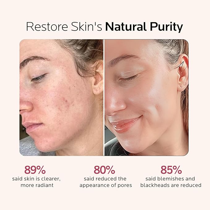 Facial Steamer Self-Care Gift Kit: Nano Ionic Face Steamer Deep Cleaning Unclogs Pores - Humidifier Hot Mist Spa Gifts for Women with 17 Skin Care Tools (Basic Glow Essentials)