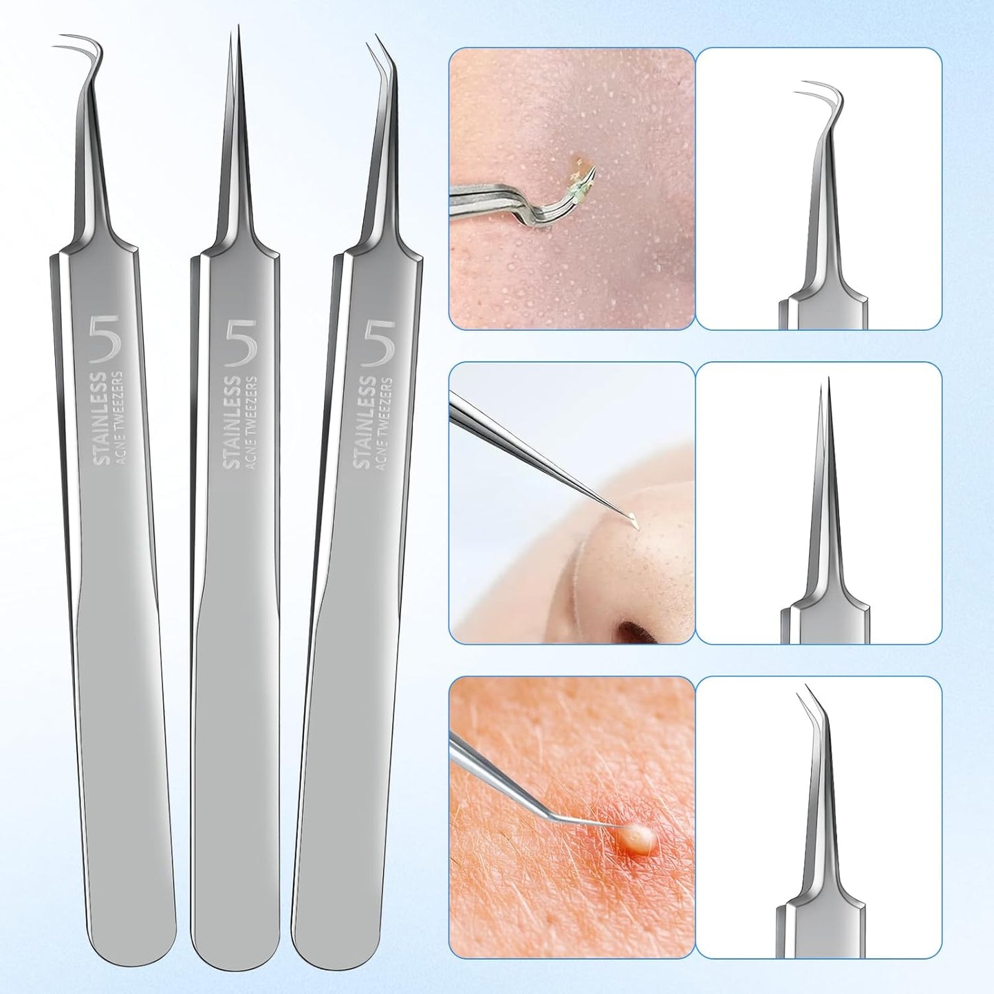 Blackhead Remover Tweezers, Pimple Popper Tool Kit, Ingrown Hair Tweezers, Blackhead Extractor, Skin Zit Acne Blemish Popping Removing Surgical Tweezers Tools for Nose Eye Face