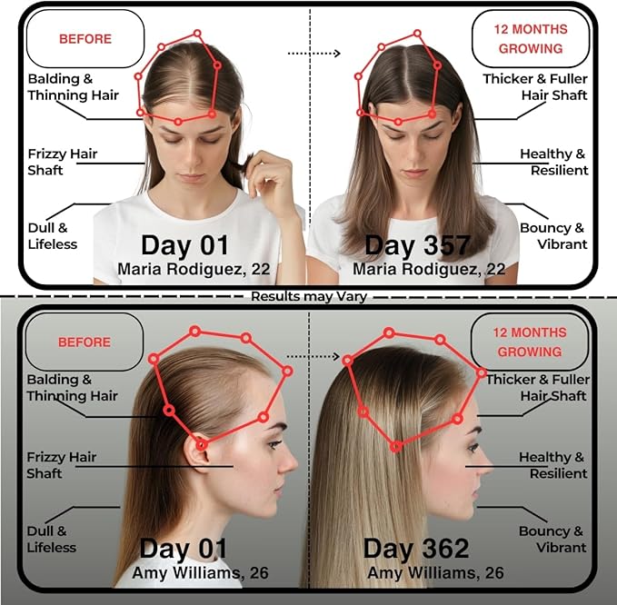 Hair Skin and Nails Vitamins, Hair Skin and Nails Gummies, Biotin Collagen Gummies, Biotin 5000mcg, Hair Vitamins, Collagen Supplements, Marine Collagen, Vitamin B12, Gifts for Women, GummBear